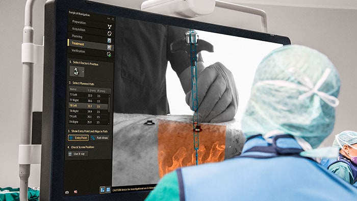 Philips Surgical Navigation Technology based on Augmented-Reality
