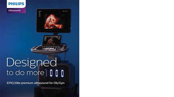 FlexVue with Orthogonal View enhances the diagnosis of a fetal facial cleft abnormality case study thumbnail