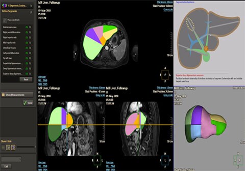 magnetic resonance liver health clinical image