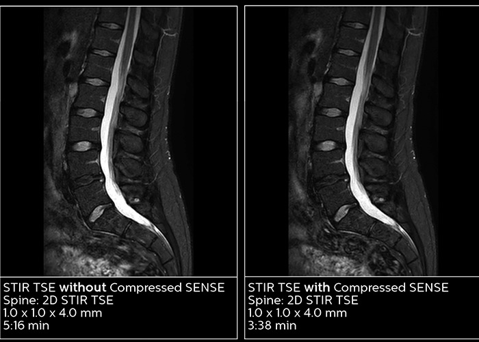 magnetic resonance for the ED