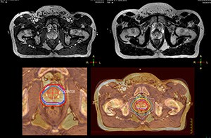 magnetic resonance thumbnail