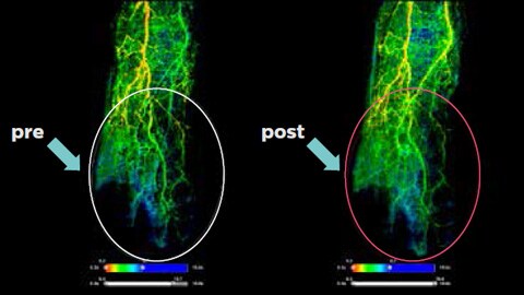 forefoot image