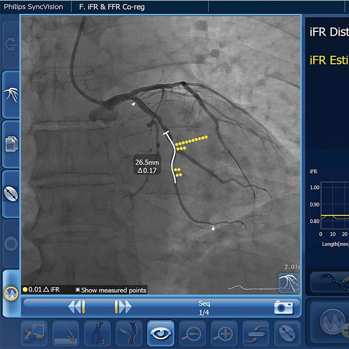 iFR software image