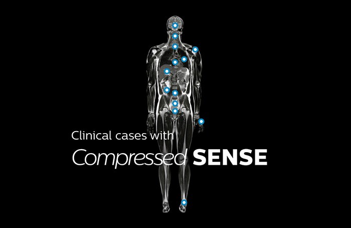 Computer, tablet and phone with MR body map page that shows clinical cases from nearly every anatomy