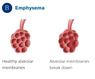 Alveolmembran
