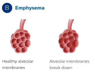 Alveolmembran