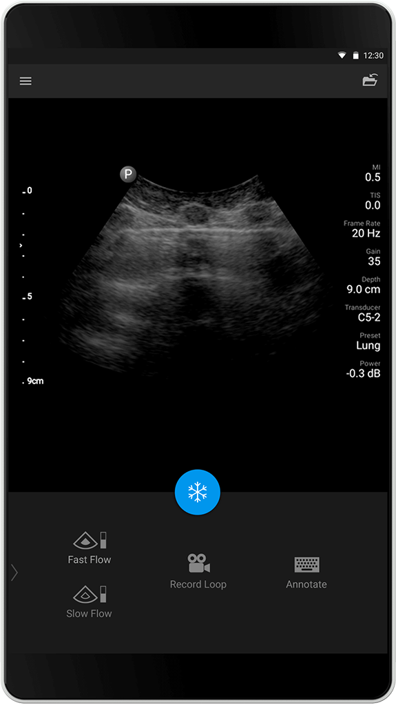 Lungundersökning C5-2