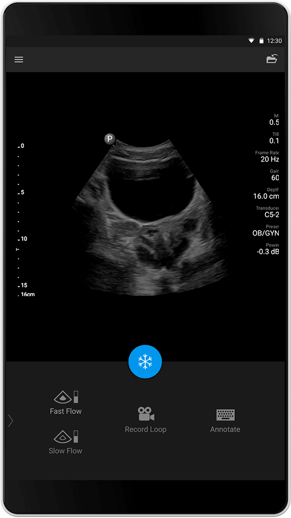 OB/GYN-undersökning C5-2