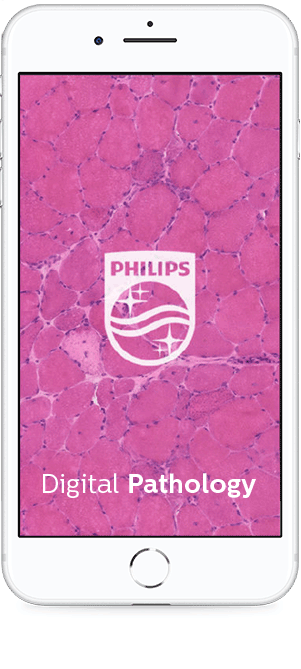 digital pathology