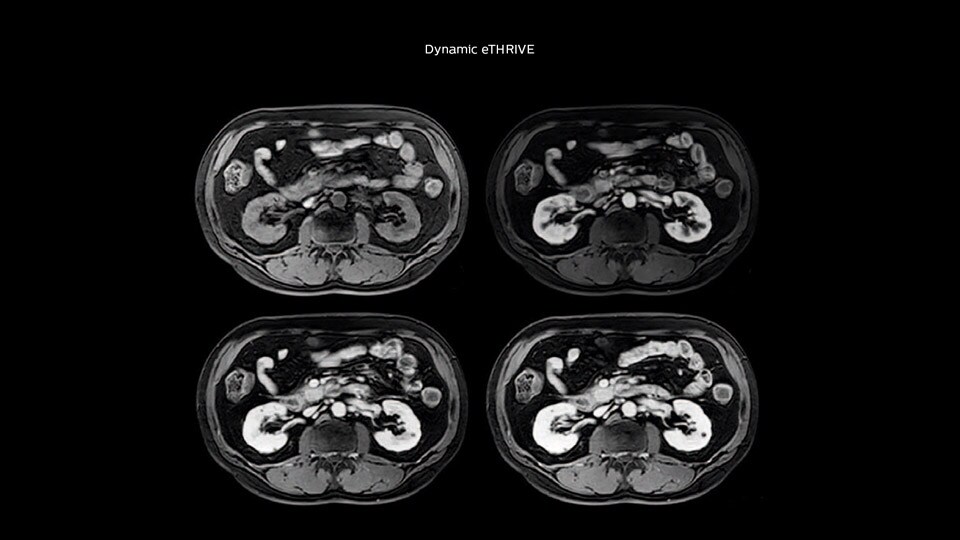 Bremen Clinical case Pancreas tumor