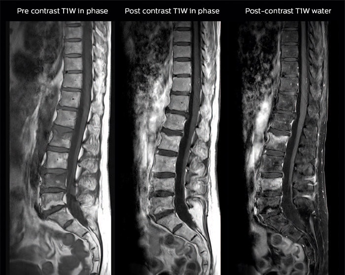 Lefebvre Case image