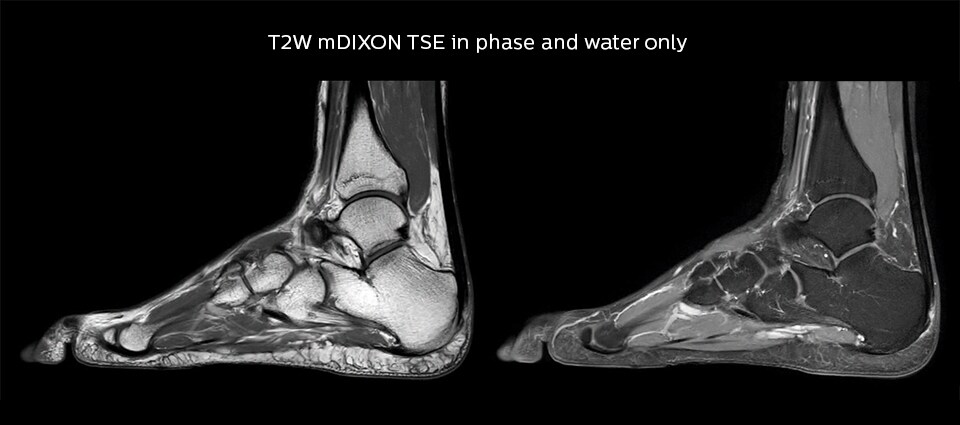 Lefebvre Case Ankle image