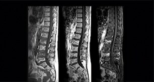 Lefebvre Case1 thmb