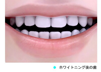 whitening