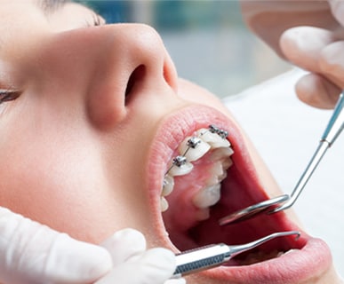 Utvärdera fördelarna med daglig användning av ortodontisk behandling med Philips Sonicare