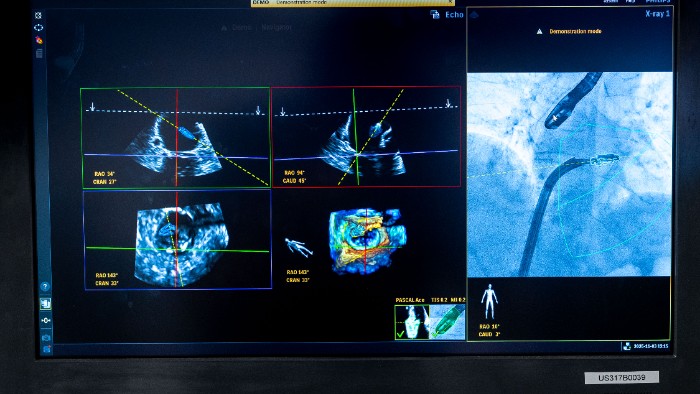 fvbf031125 1509 asset