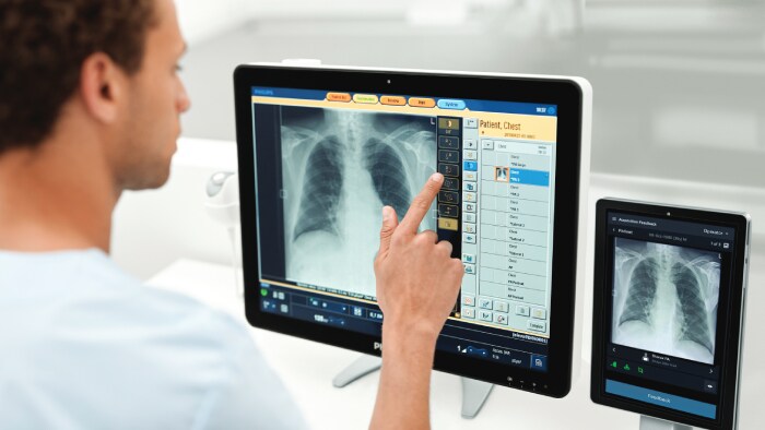 Philips debuts AI-powered Radiology Smart Assistant in Nordics to enhance radiography image acquisition